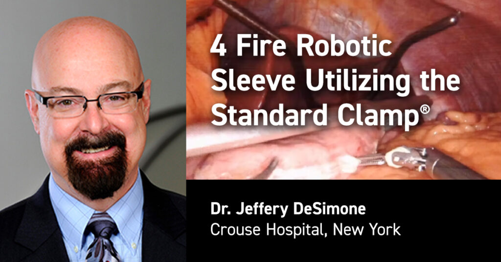 DeSimone - 4 Fire Robotic Sleeve Utilizing Clamp