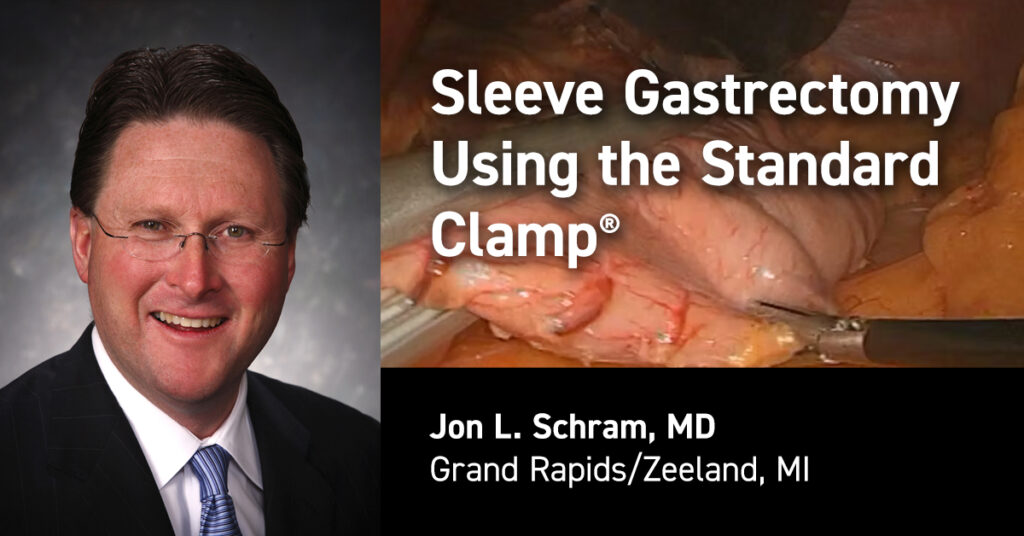 John Schram - Standard Bariatrics