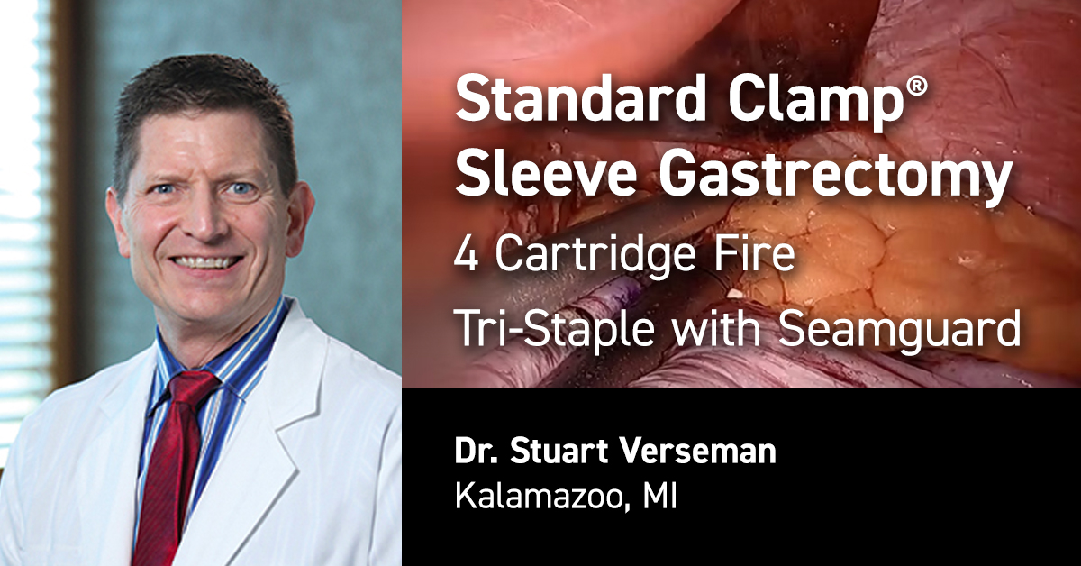 Stuart Verseman with the Standard Clamp - Standard Bariatrics