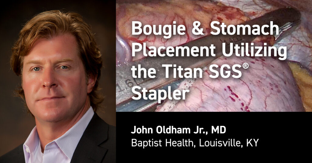 Dr John Oldham Bougie & Stomach Placement Titan - Standard Bariatrics