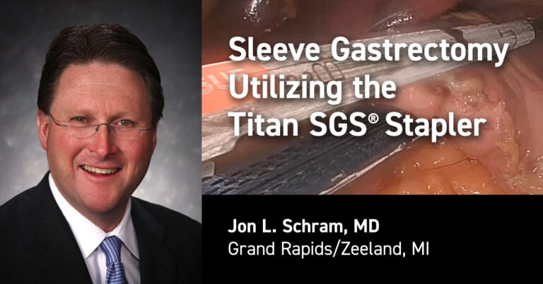 Dr Schram SG - Utilizing the Titan SGS Stapler - Standard Bariatrics