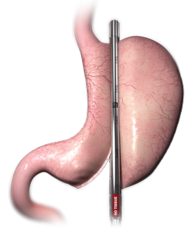 Stomach_Resources Stomach_Resources